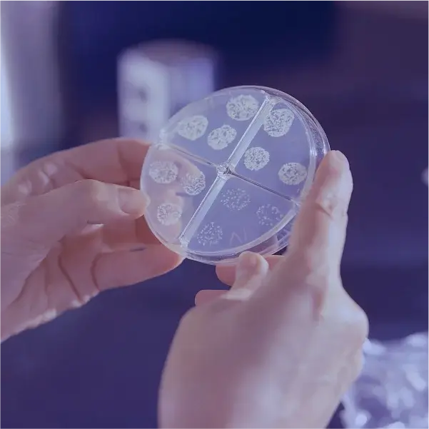 Руки держат чашку Петри с небольшими круглыми бактериальными культурами, разделёнными на четыре секции. Сцена создаёт научную и сосредоточенную атмосферу.